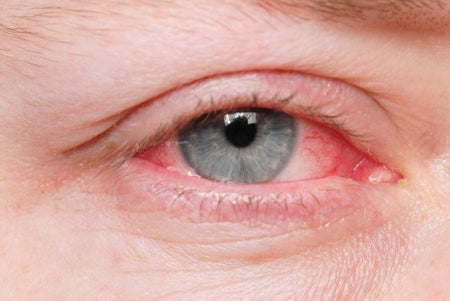 Blue eye with pink eye